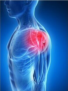 chronic shoulder pain